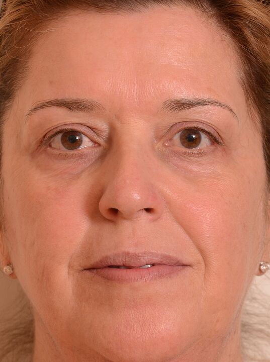 J'ai rajeuni mon visage avec de la crème Eudalie