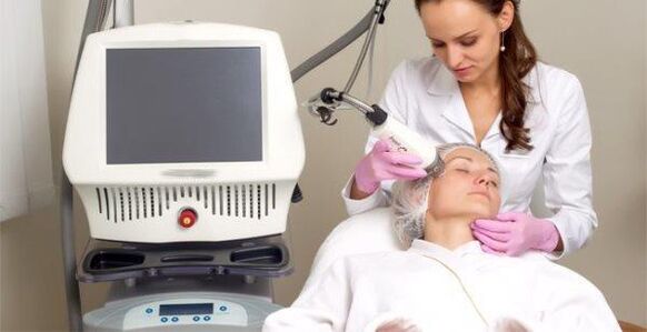 Effectuer la procédure