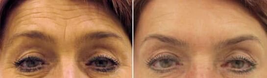 Field Field Rajeunnation