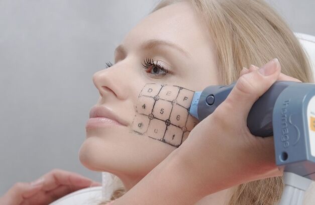 Procédure thermique